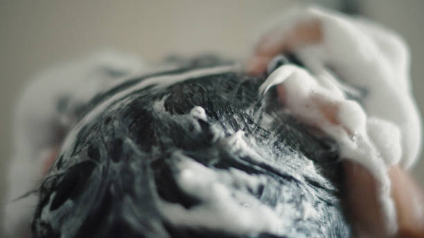 Psoriasis Scalp Shampoo