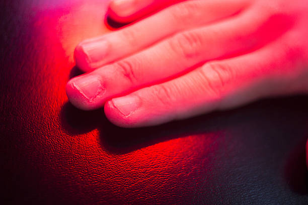 Red Light Therapy for Nail Psoriasis Australia