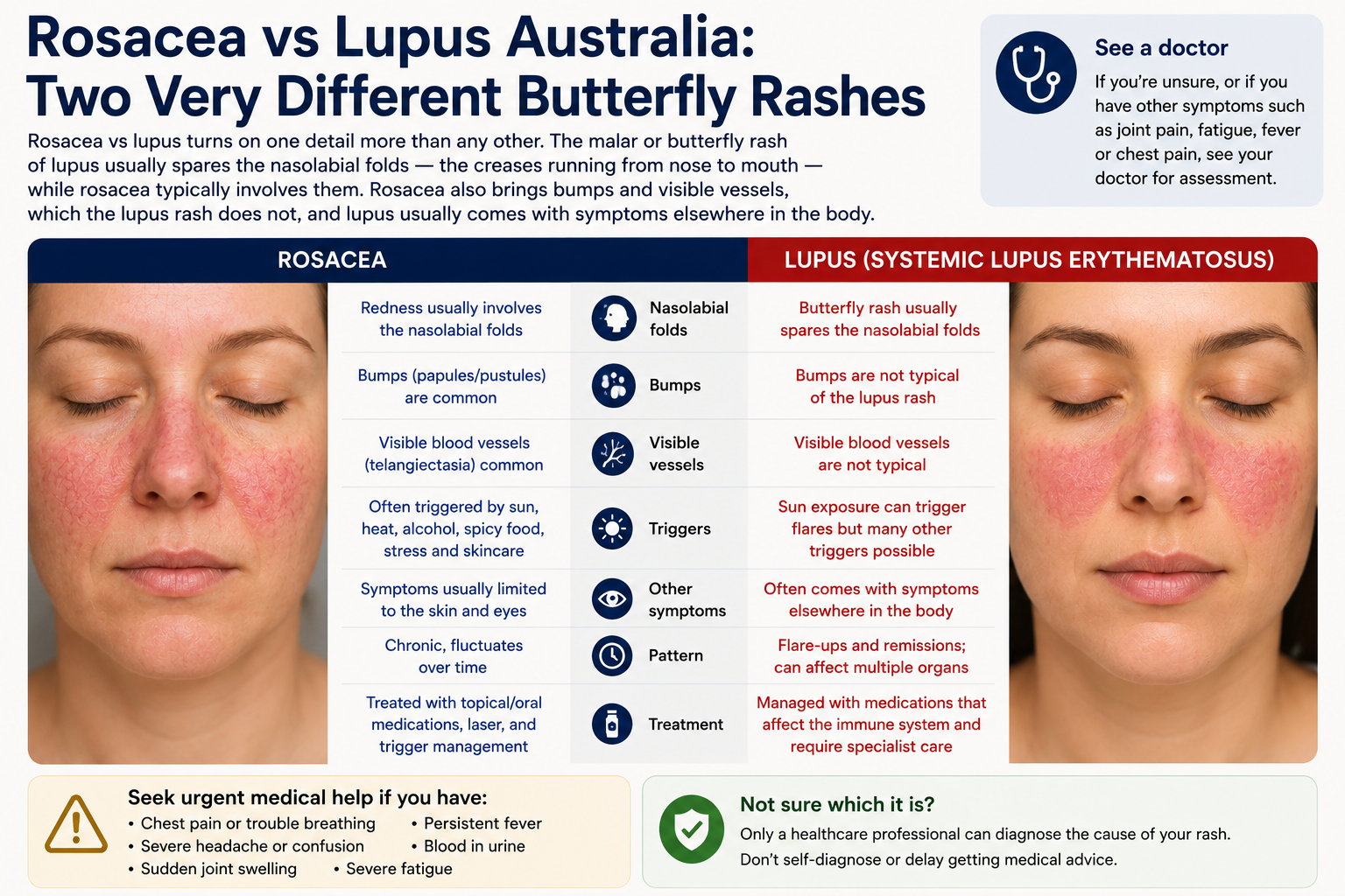 Rosacea vs Lupus Australia