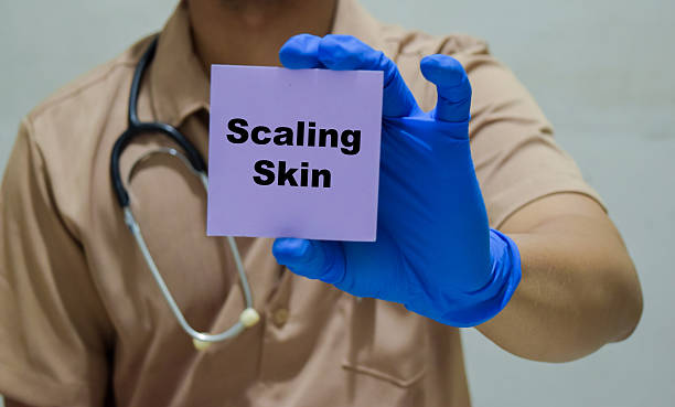 Scaly Skin Australia: Common Causes Explained