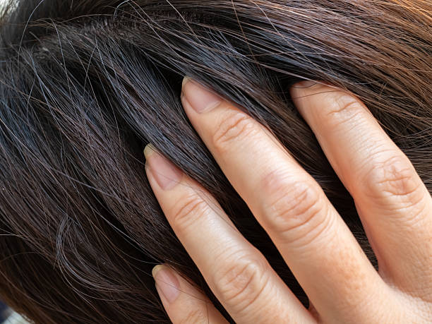 Scalp Moisturiser Australia