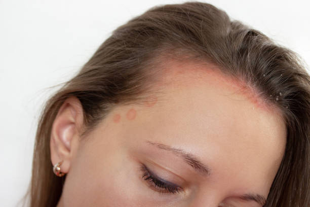 shampoo for itchy scalp australia
