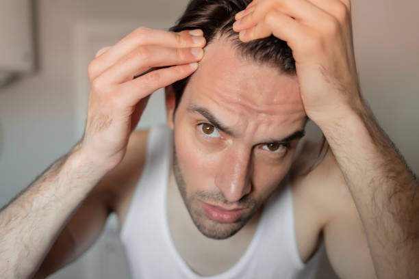 scalp psoriasis and hair loss will it grow back australia