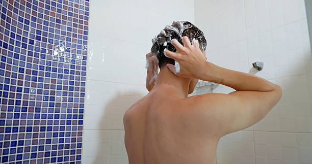 Scalp Psoriasis Shampoo