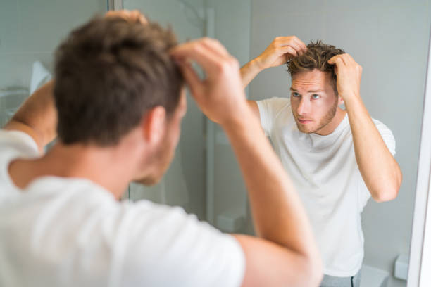 Ketoconazole vs Zinc Pyrithione Shampoo Australia
