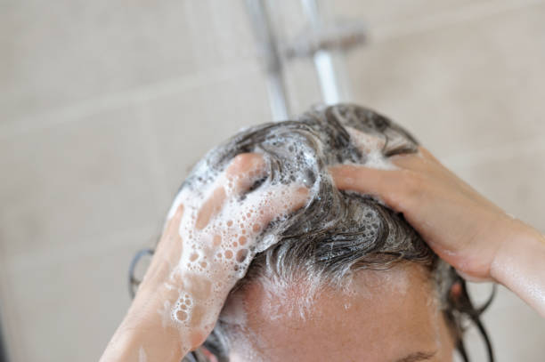 Psoriasis Shampoo Ingredients to Avoid