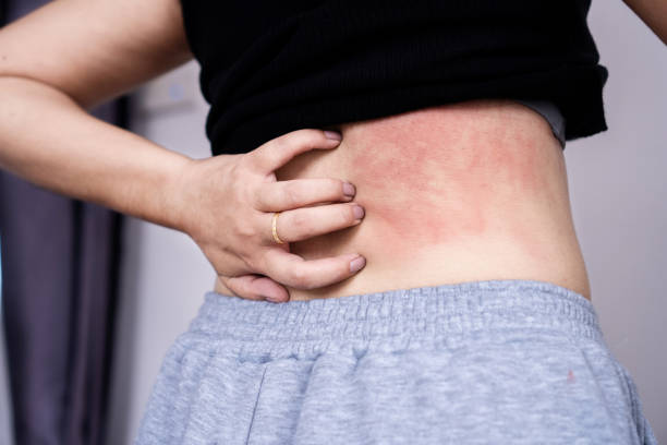 Skin Conditions Australia