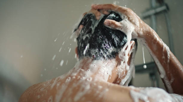 Tar Based Shampoo for Psoriasis Australia