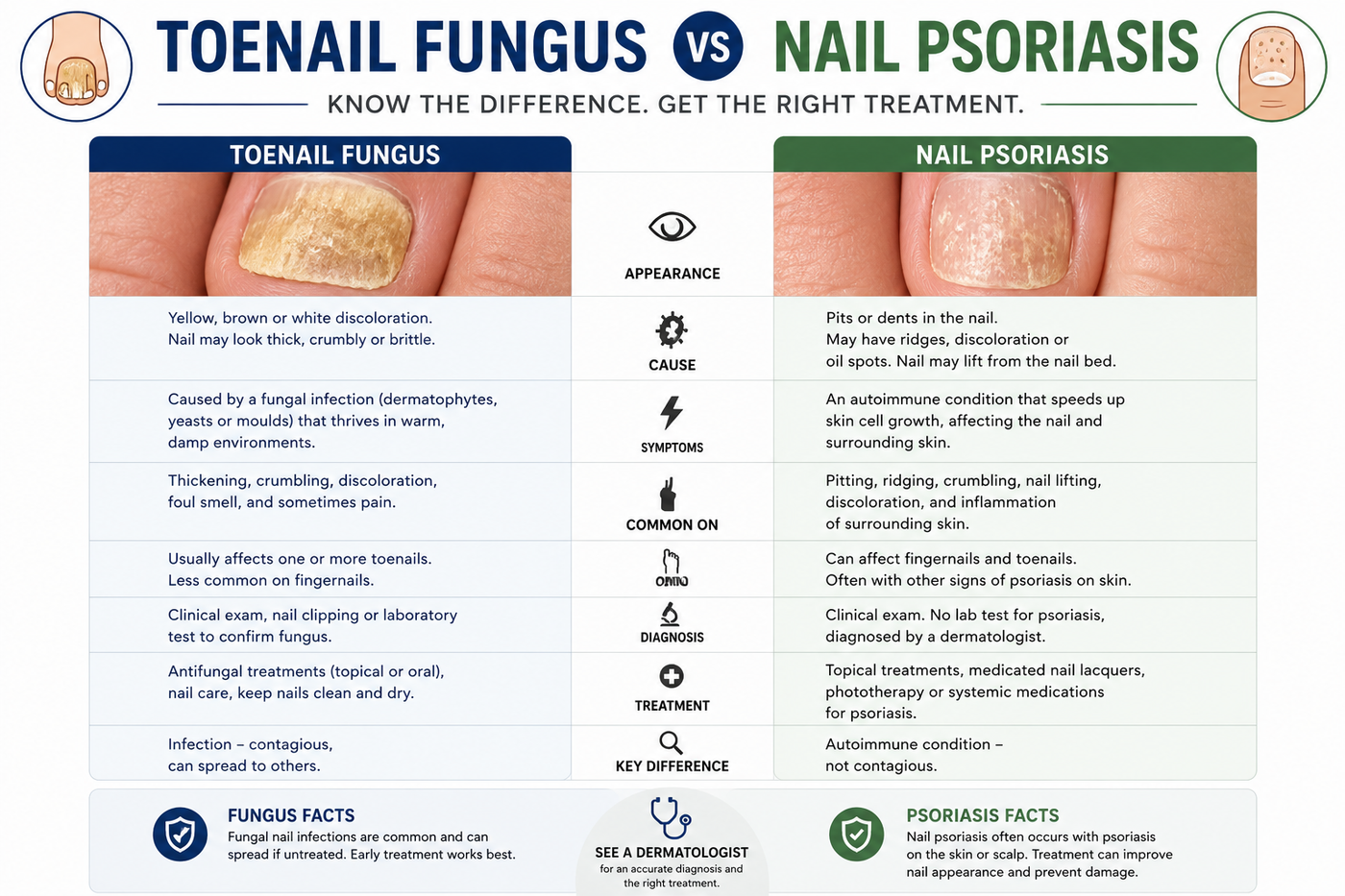 Toenail Fungus vs Nail Psoriasis Australia