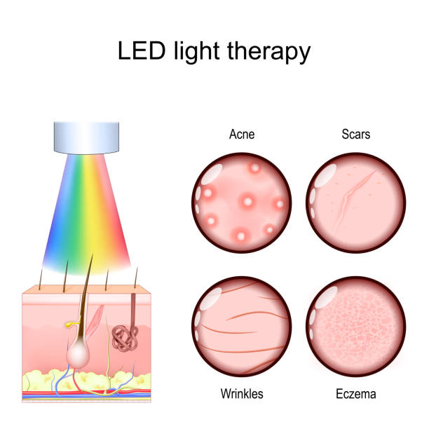 uvb vs led light therapy
