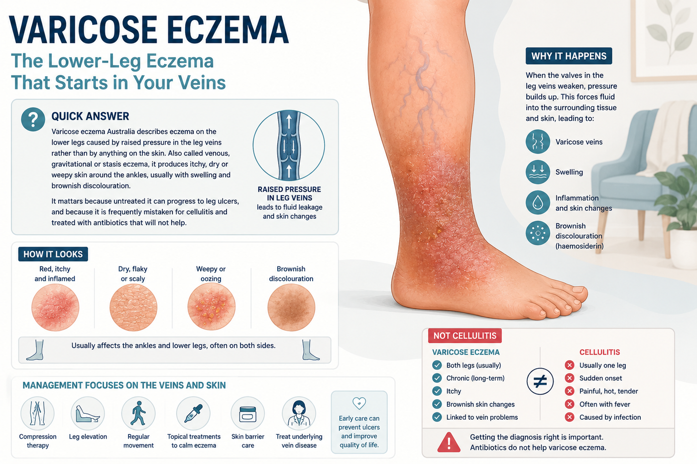 Varicose Eczema Australia