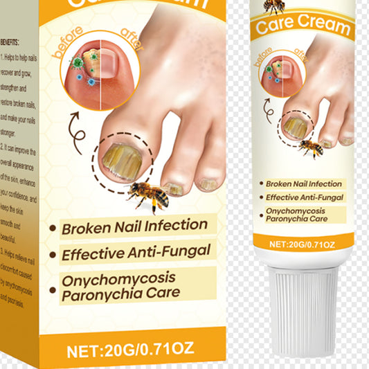 Psoriasis Care Cream For Grey Nails