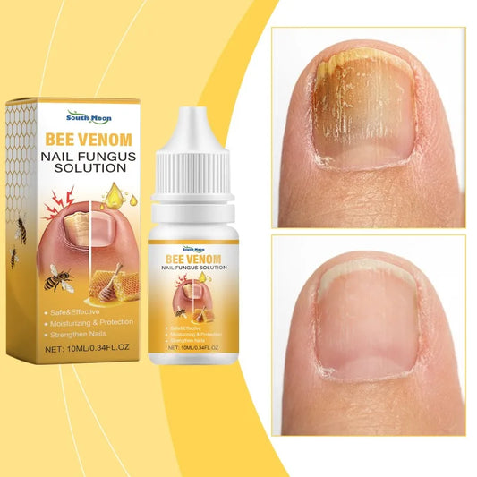 Bee Venom Nail Solution