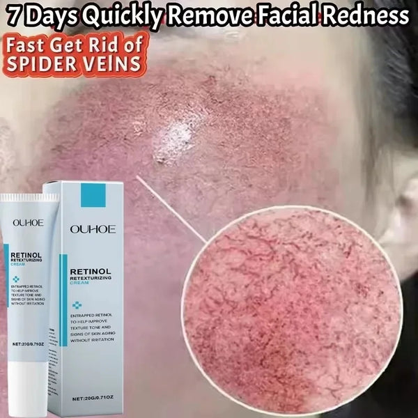 Ouhou Retinol Retexturising Cream helping improve the appearance of facial redness and uneven skin texture