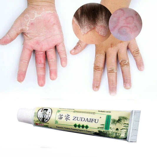Zudaifu Itching Treatment Cream