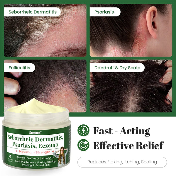 Sumifun Maximum Strength Antibacterial Cream image Soothing Skin Relief Cream