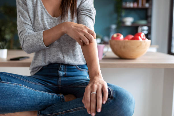 Psoriasis vs Eczema