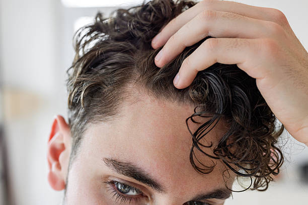 does sweating make scalp psoriasis worse australia